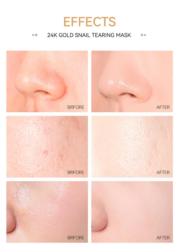 24K Gold Laikou Peeling Face Mask - Anti-Wrinkle, Blackhead & Whitening Care