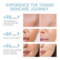 LAIKOU™ Milk Glow Set – Deep Hydration & Brightening Facial Kit