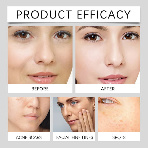 Hoygi™ Vitamin C Radiance Cream – Deep Hydration & Rejuvenation (40ml)