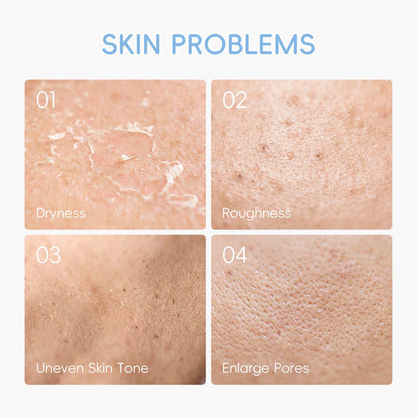 LAIKOU™ Milk Glow Set – Deep Hydration & Brightening Facial Kit