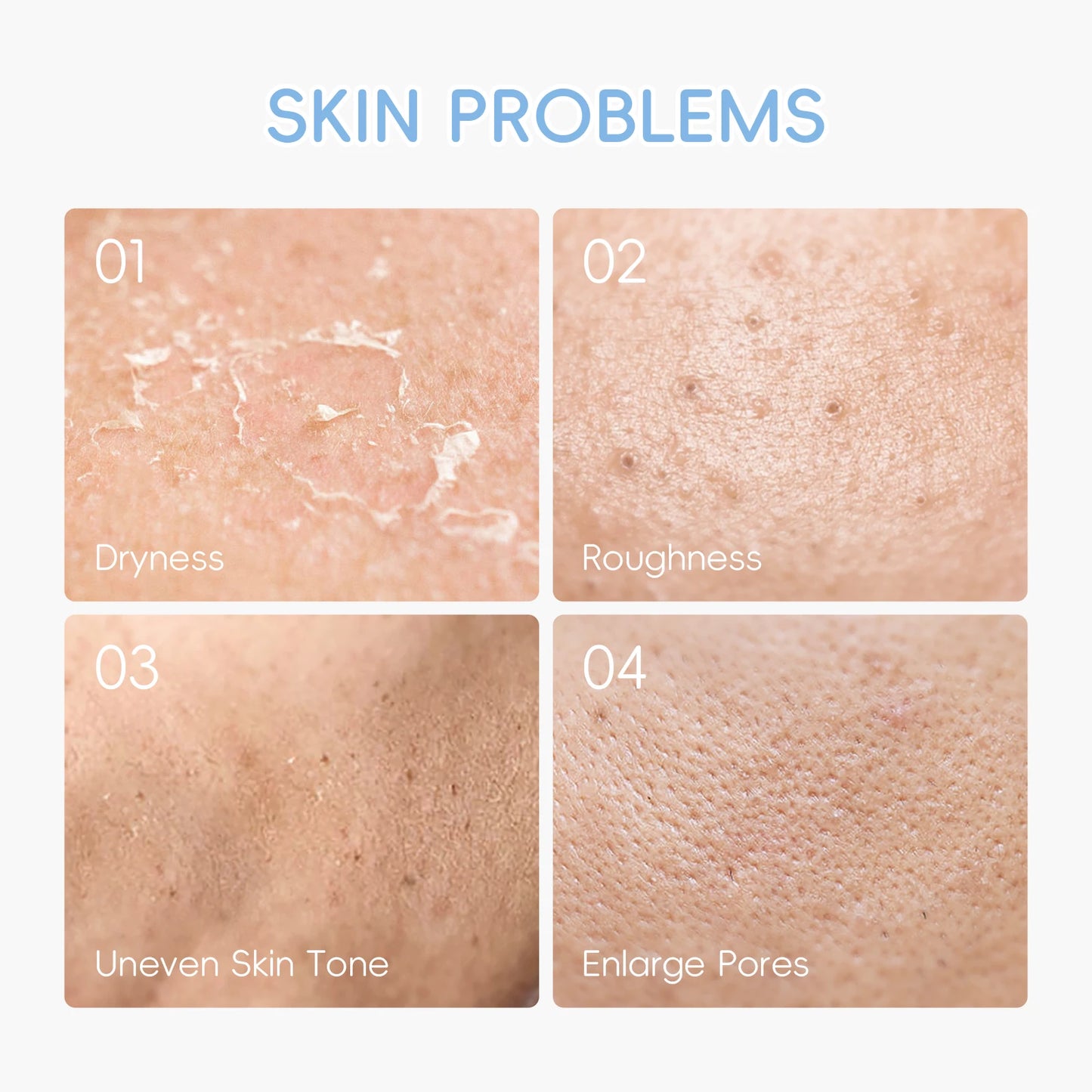 LAIKOU™ Milk Glow Set – Deep Hydration & Brightening Facial Kit