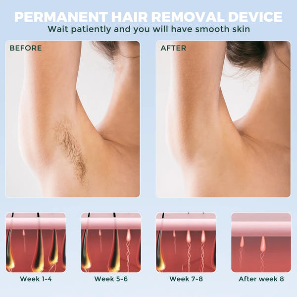 Sejoy™ IceCool IPL Laser – Painless Hair Removal Device for Smooth Skin